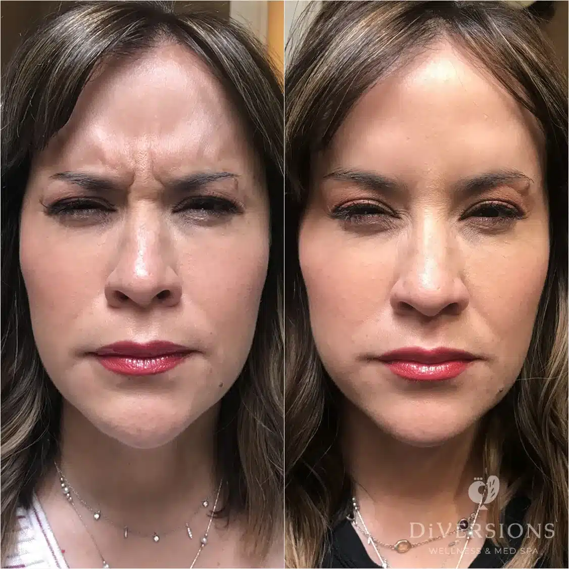 ig img